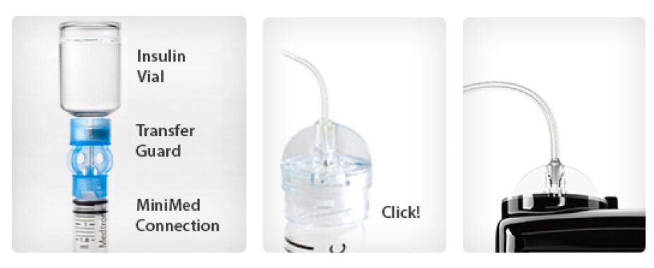 insulin pump - Infusion Sets